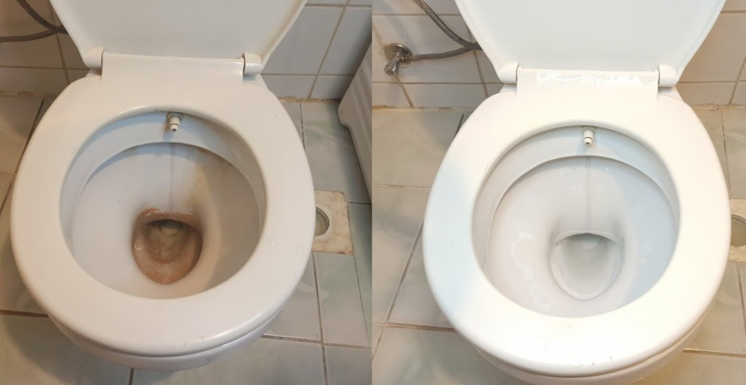 klozet lekeleri