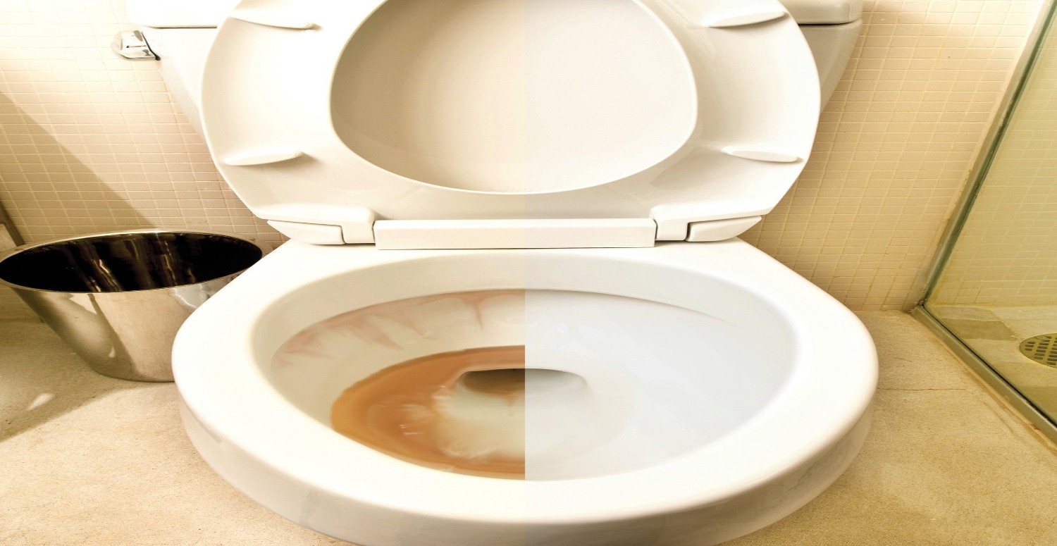 Klozetteki sarı lekeleri silgi gibi siliyor! Kötü görüntüden deterjansız kurtaracak