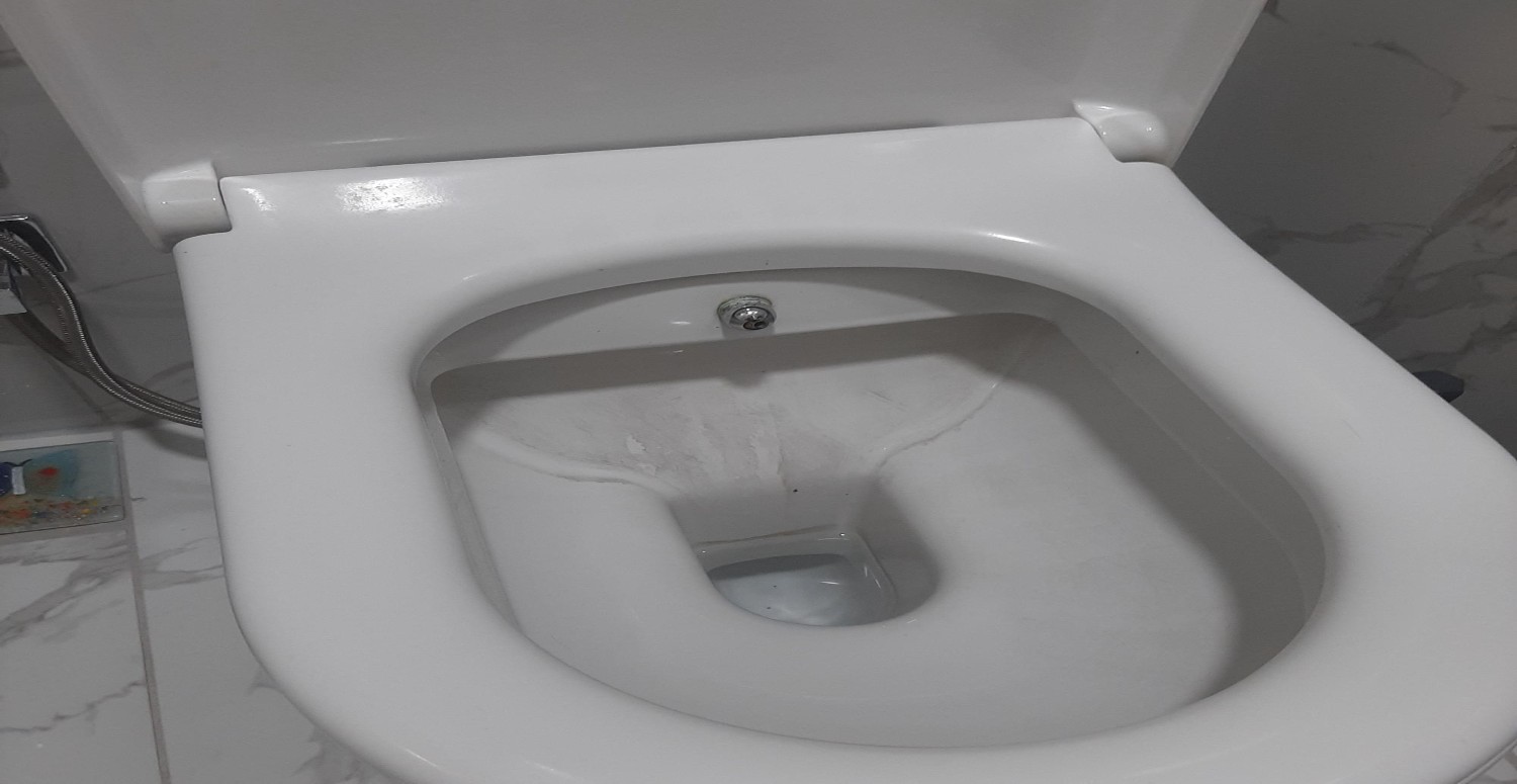 Klozetteki lekeleri silgi gibi siliyor! Çamaşır suyu kullanmadan ışıl ışıl yapıyor