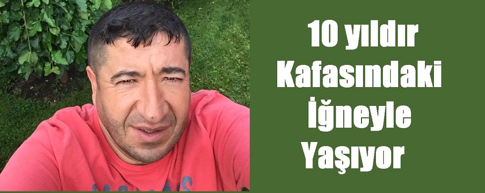 10 Yıldır Kafasındaki İğneyle Yaşıyor